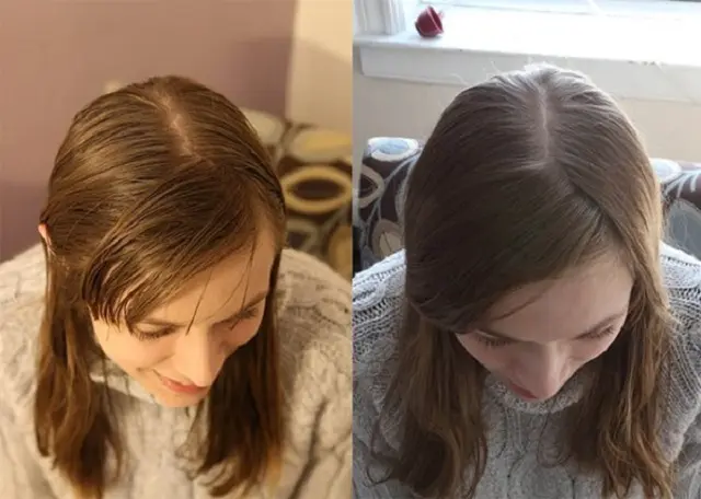 ¿Por qué no debería lavarme el cabello con champú?